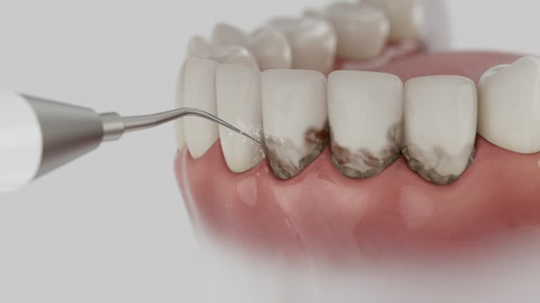 Trusted Teeth Cleaning And Checkup service in Melcher-Dallas, IA - Dentist Open Now